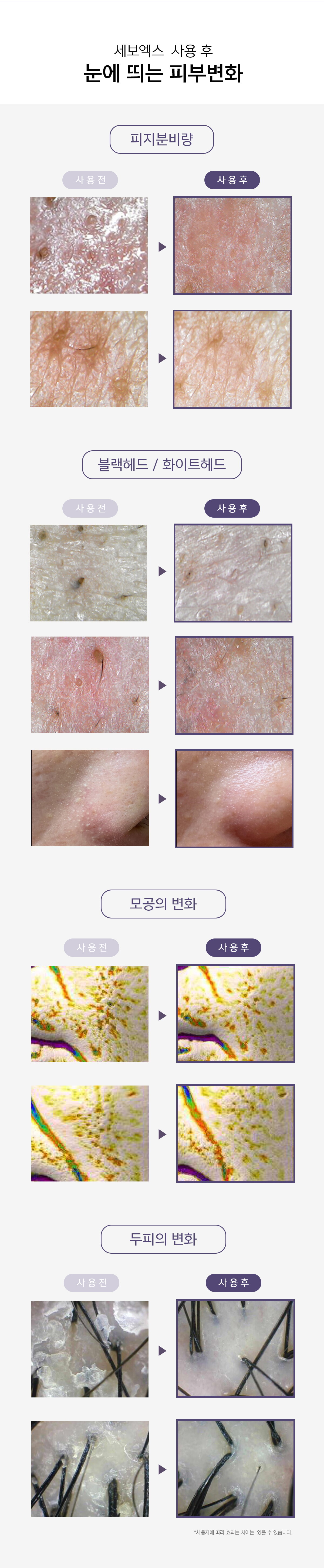 세보엑스-상세페이지_02