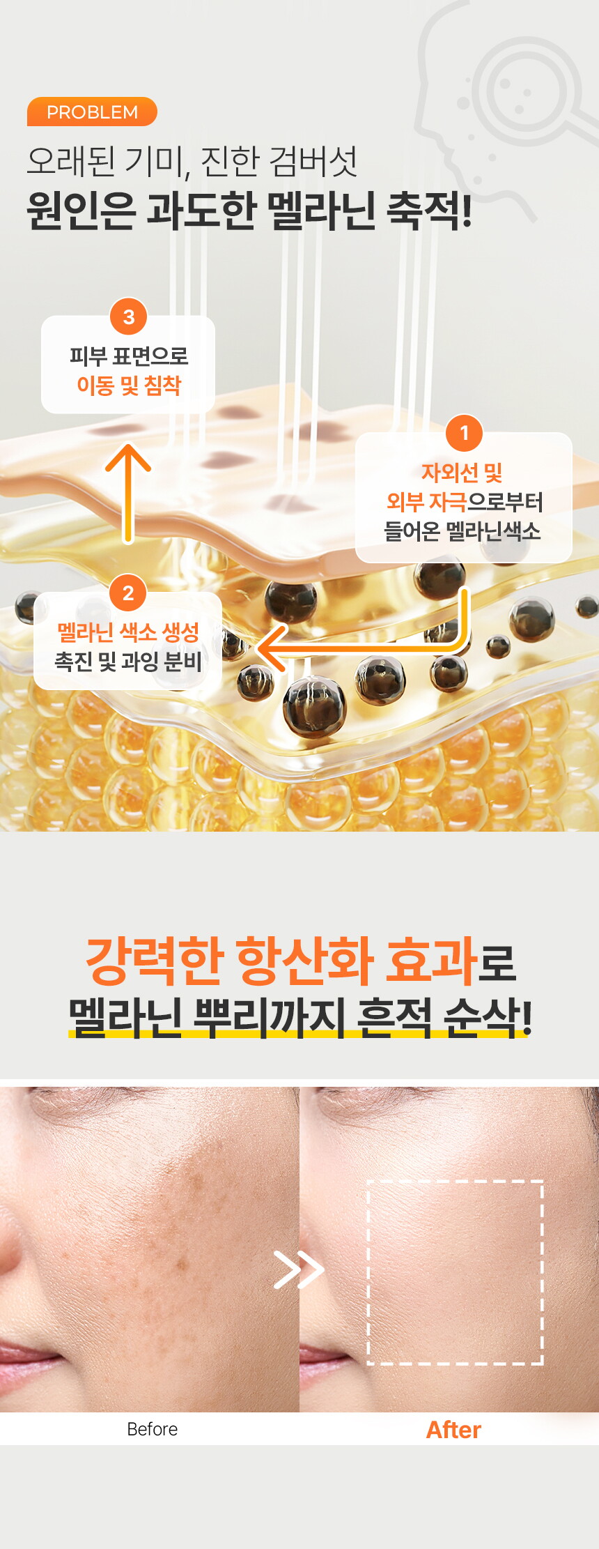 (분할1)-글루타치온-상세페이지_860_03(이거사용).jpg