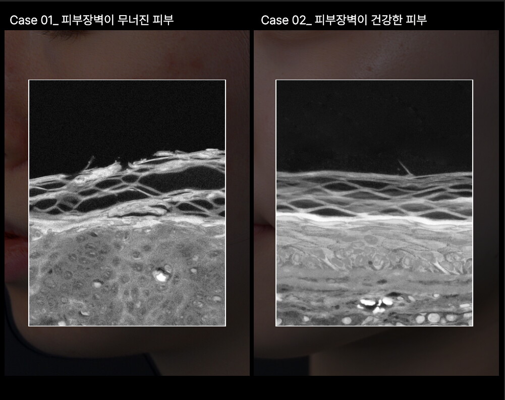 상세페이지_히알베리어로션 (5)