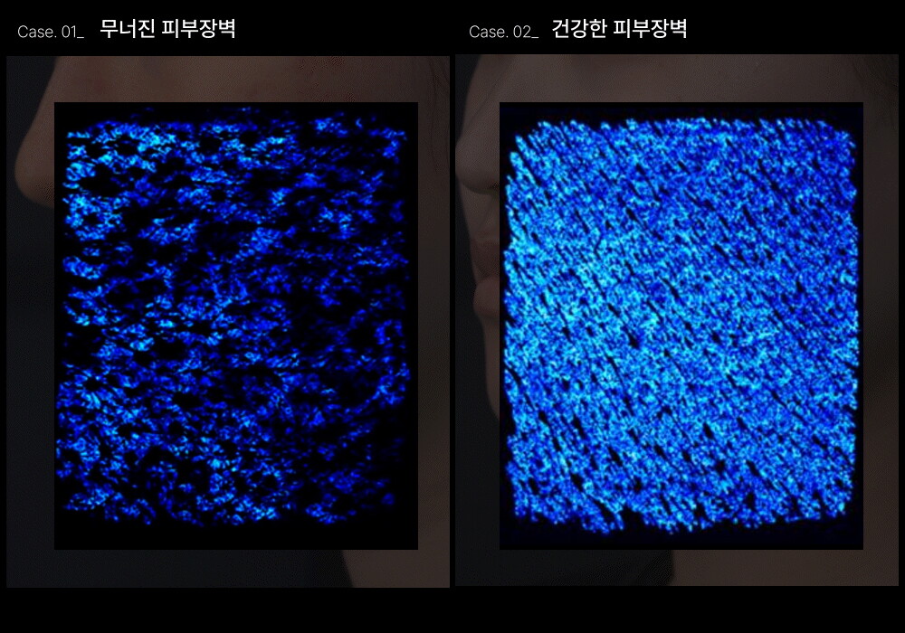 상세페이지_히알베리어로션 (8)