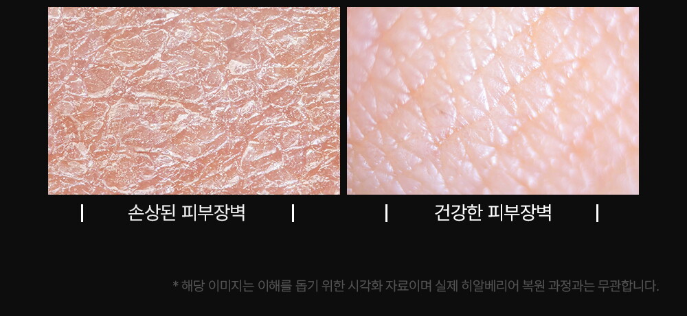 상세페이지_히알베리어로션 (15)