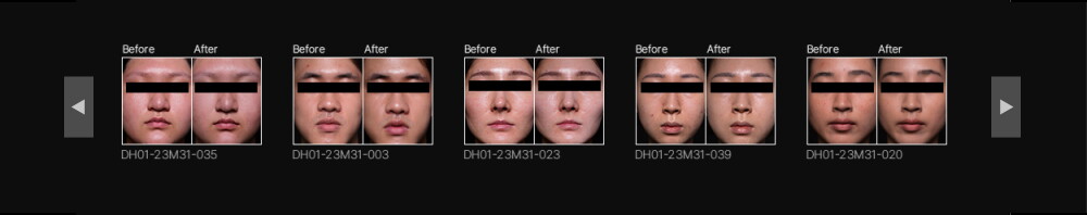 상세페이지_히알베리어로션 (29)