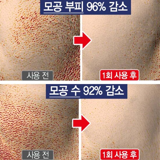 숯카마클렌저 6개 +멜라7 크림 1개 (사은품)