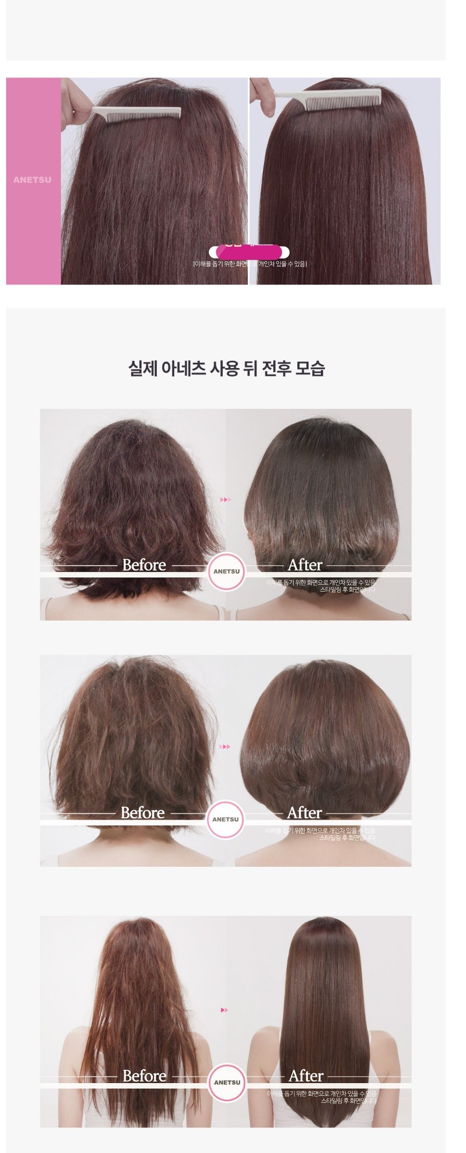 아네츠상세페이지 (9)